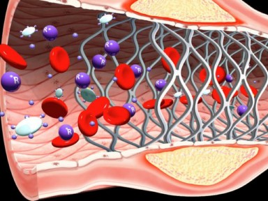 siln-stent